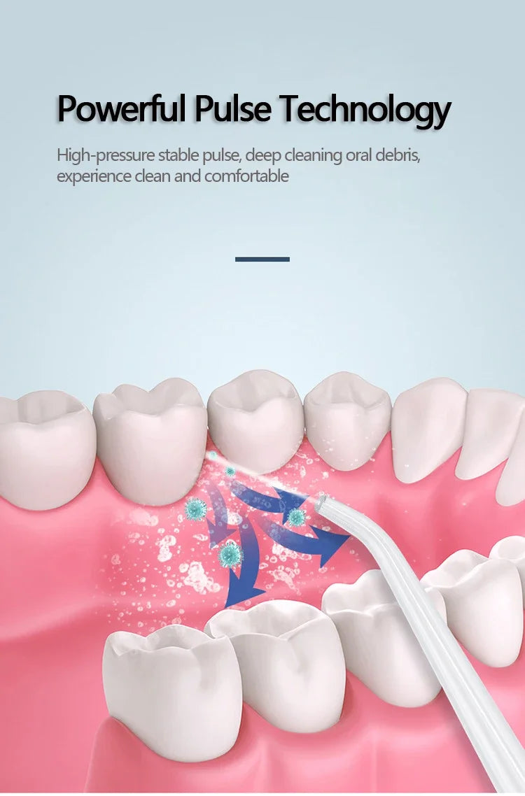 Irrigador bucal, irrigador bucal, irrigador bucal, aparato de limpieza dental, hilo dental, máquina de lavado bucal, blanqueamiento dental, herramientas de limpieza.