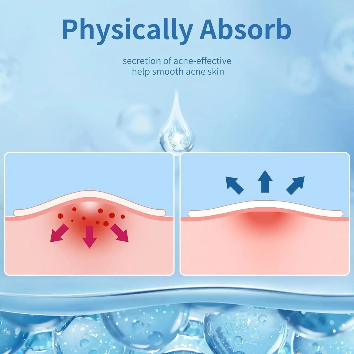 360 parches invisibles para el acné, antiinflamatorios, curativos y absorbentes, para el cuidado de la piel.